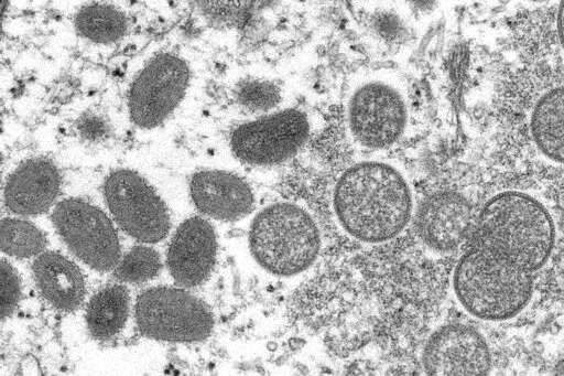This 2003 electron microscope image made available by the Centers for Disease Control and Prevention shows mature, oval-shaped monkeypox virions, left, and spherical immature virions, right, obtained from a sample of human skin associated with the 2003 prairie dog outbreak. WHO's top monkeypox expert Dr. Rosamund Lewis said she doesn’t expect the hundreds of cases reported to date to turn into another pandemic, but acknowledged there are still many unknowns about the disease, including how exa