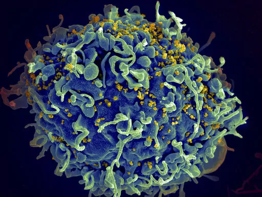This colorized electron microscope image made available by the U.S. National Institutes of Health shows a human T cell, indicated in blue, under attack by HIV, in yellow, the virus that causes AIDS. In a study released in the journal Nature on Thursday, April 28, 2022, climate change will result in thousands of new viruses spread among animal species by 2070, which is likely to increase the risk of emerging infectious diseases jumping from animals to humans. (Seth Pincus, Elizabeth Fischer, Aust