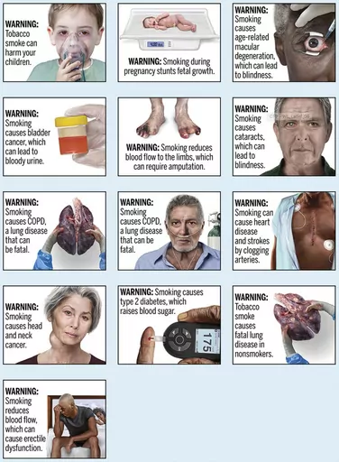 This image provided by the U.S. Food and Drug Administration, Thursday, Aug. 15, 2019, shows proposed cigarette warning labels. A federal rule requiring that cigarette packs and advertising include graphic images demonstrating the effects of smoking, including pictures of smoke-damaged lungs and feet blackened by diminished blood flow, does not violate the First Amendment, a federal appeals court ruled Thursday, March 21, 2024. (FDA via AP, File)