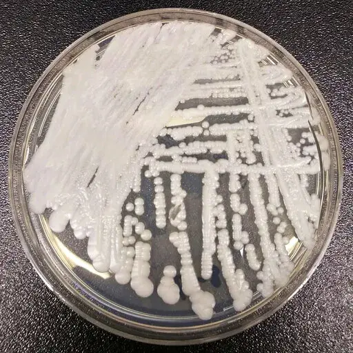 This 2016 photo made available by the Centers for Disease Control and Prevention shows a strain of Candida auris cultured in a petri dish at a CDC laboratory.  A hospital in New Orleans says, Wednesday, Jan. 19, 2022,  it has identified two patients infected with a rare, drug-resistant fungus — the first time it's been found in Louisiana. Candida auris has already been found in Washington, D.C., and at least 20 other states including Georgia, Florida and Texas, according to the Centers for Dis